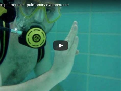 L'appellation maladie pulmonaire obstructive chronique (mpoc) s'applique tant à la bronchite chronique qu'à l'emphysème. Épinglé par cleanmix sur plongee | Plus jamais, Douleur ...