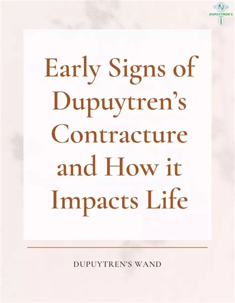 Ppt Early Signs Of Dupuytrens Contracture And How It Impacts Life