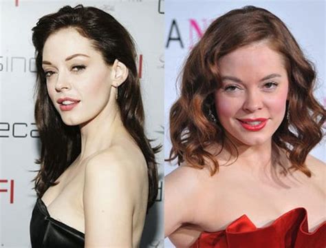 Rose Mcgowan Before And After Plastic Surgery Celebrity Plastic