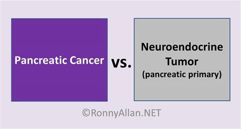 Can You Live Without A Pancreas Cancer Cancerwalls