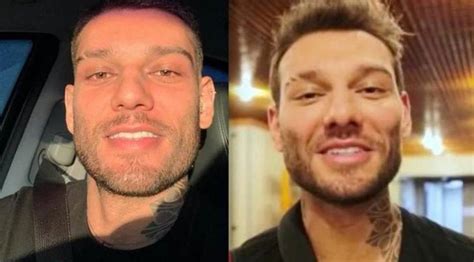 Antes e depois fibra de vidro #inlove #fibradevidro #damaresnails. Confira o antes e depois dos famosos que fizeram ...