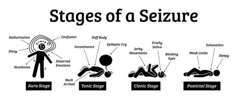 what to do if someone is having a seizure premier neurology and wellness center