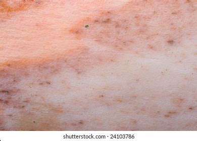Acne On Facial Skin Dermatological Disease Stock Photo Edit Now