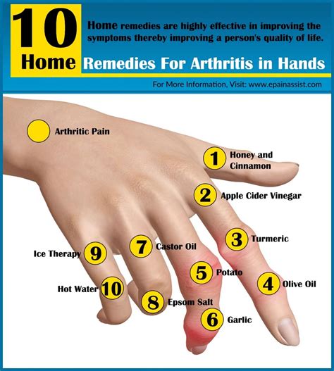 How To Prevent Arthritis In Fingers Check More At