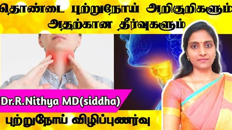 தொண்டை புற்றுநோய் அறிகுறிகள் Throat Cancer Treatment In Tamil Dr