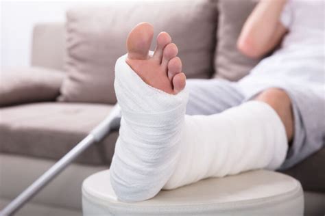 How Much Compensation For A Broken Leg Case Study And Guide On Broken