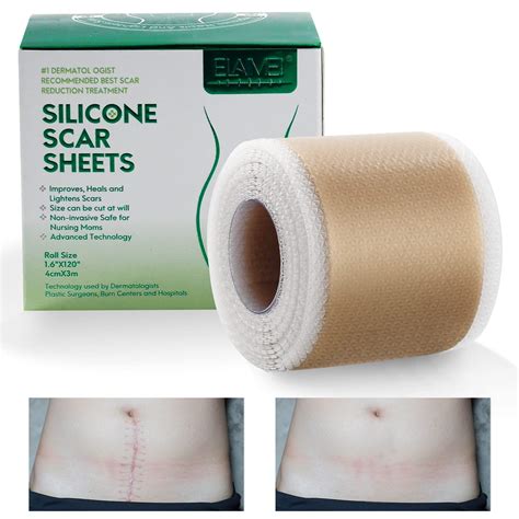 Buy Away Silicone Sheets Removal Tape Medical Grade Silicone Strips