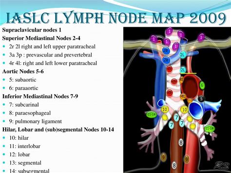 Tnm Staging Lung Cancer Lymph Nodes