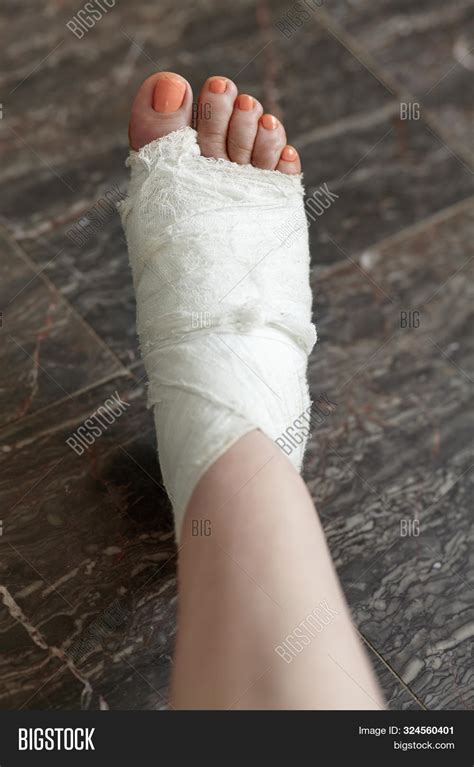 female leg girl leg bandage images
