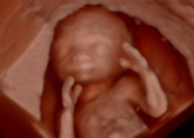 Video Image Gallery Mother Nurture Ultrasound