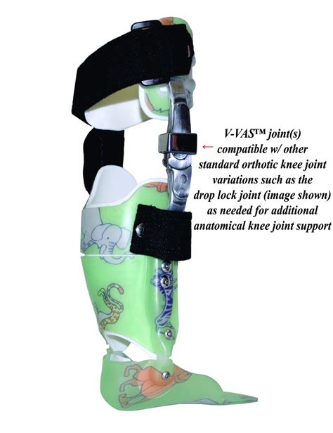 Pediatric Orthotics Custom Knee Ankle Foot Orthosis Kafo Brace