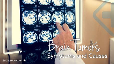 Brain Tumor Symptoms Could I Have One Youtube