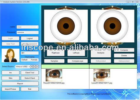 Analizador De Iris Pro De Cámara De Iridología Ocular Usb De 12mp
