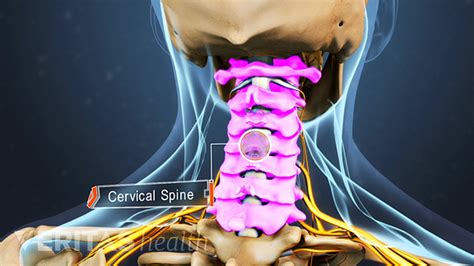 Cervical Spine Anatomy And Neck Pain