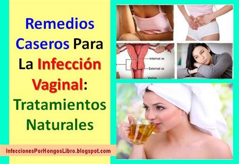 Remedios Caseros Para La Vaginitis Bacteriana Infeccion Vaginal Sexiz Pix