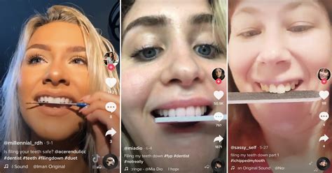 Dentists Warn Against Tiktok Trend For People Using Nail Files On Their