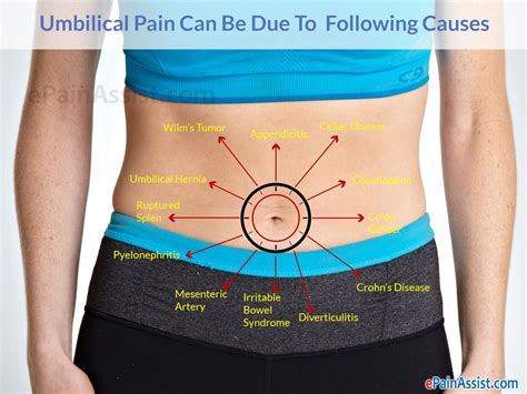 Stomach Hernia Above Belly Button