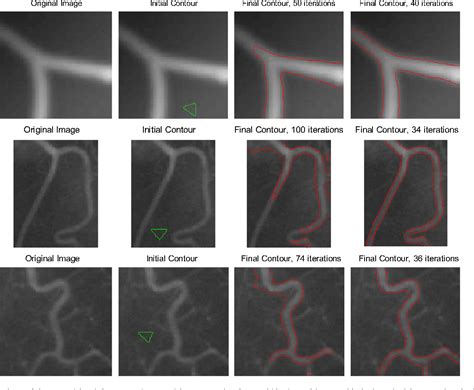 Figure 1 From An Efficient Local Chan Vese Model For Image Segmentation