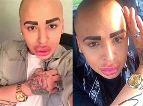 guy spends 150 000 in plastic surgery to look like kim kardashian