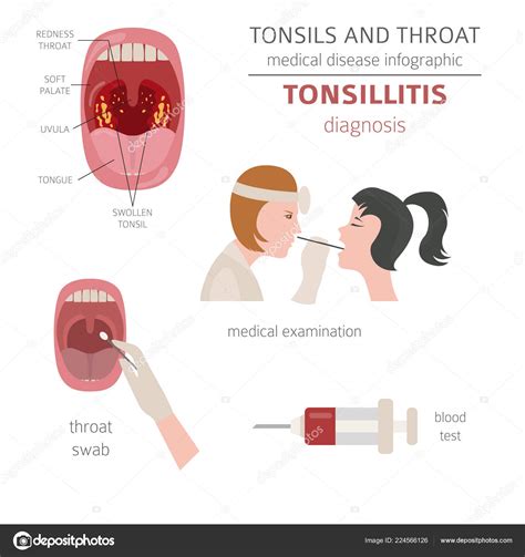 Tonsils Throat Diseases Pharyngitis Symptoms Treatment Icon Set Medical Infographic Stock Vector