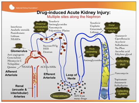 Acute Kidney Injury Pathophysiology