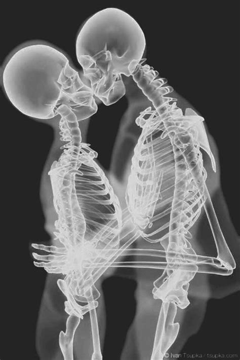 X Ray Kiss Bones Lovers Kissing Black And White Love Kiss