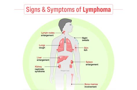 Signs And Symptoms Of Lymphoma