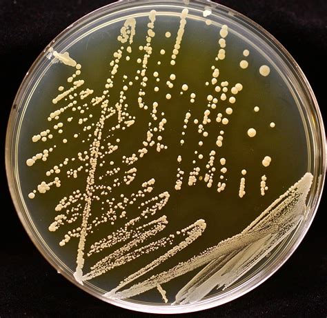 Uma Colônia De Bactérias Triplica A Cada Hora