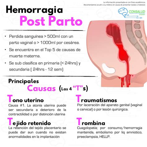 Hemorragia Post Parto Obstetricia Obstetricia Y Puericultura Y
