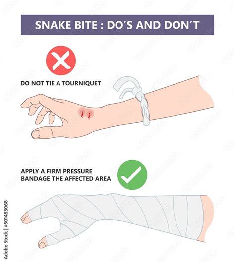 Naklejka Snake Bite First Aid Care Non Venomous Anti Venom Serum Hand