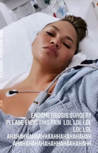 Chrissy Teigen Posts Body Positive Selfie Of Scars