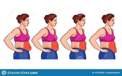 Four Types Of Belly In Women Stock Vector Illustration Of Diet