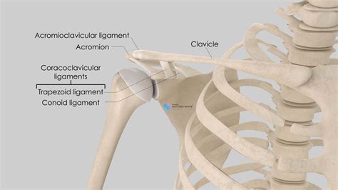 Acromioclavicular Joint Dislocation With Associated Brachial Plexus