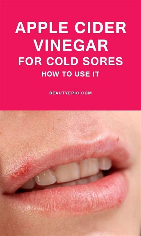 Red Dot On Lip Not Cold Sore