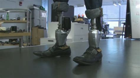 Bionic Limbs Transform Lives Cnn Video