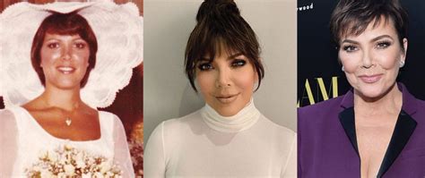 Kris Jenner Plastic Surgery Before And After Pictures 2024