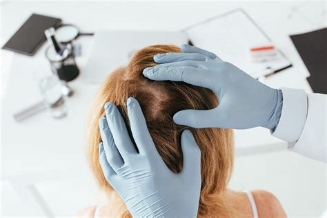 Skin Partners Brisbane Dermatologist Hair Loss Specialist Brisbane