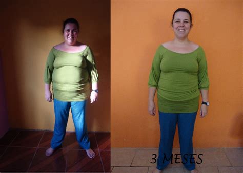 Dieta Bariátrica Após 90 Dias