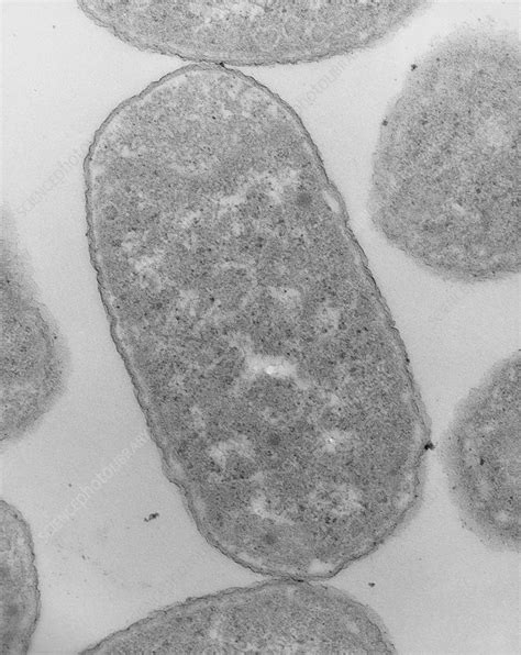 Tem Of Escherichia Coli 0111 Bacteria Stock Image B2300159
