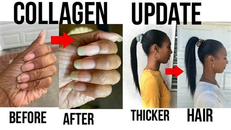 Collagen Update For Thicker Hair And Longer Nails Youtube