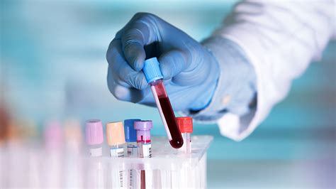 The Power And Promise Of Liquid Biopsies