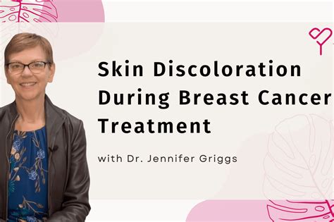 How To Understand Skin Discoloration During Breast Cancer Treatment