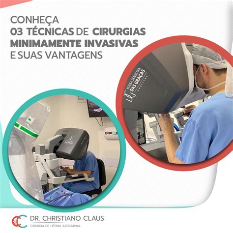 Conheça técnicas de cirurgias minimamente invasivas e suas vantagens Dr Christiano Claus