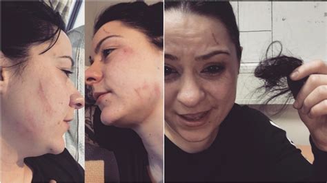 Two Women Arrested After Alleged Attack On X Factors Lucy Spraggan Itv News