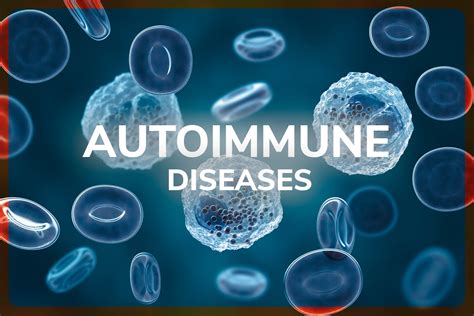 Natural Treatment For Autoimmune Diseases Immunity Therapy Center