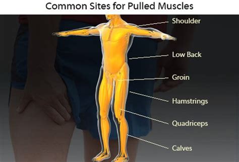 The number of muscles having one or both attatchments within the back as a whole is huge. Sports Injuries: Types, Treatments, and Prevention