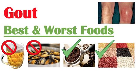 Best And Worst Foods To Eat With Gout Reduce Risk Of Gout Attacks And Hyperuricemia Youtube