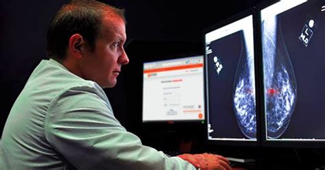 Mamografia Tudo Sobre Exame E Como Funciona Star Telerradiologia
