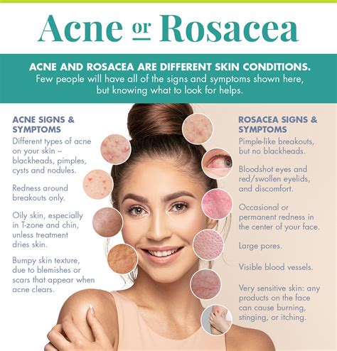 Acne Or Rosacea The Differences Between These Skin Conditions