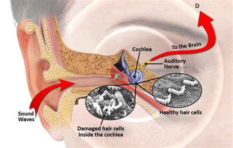 Tinnitus is the sensation of noises in the head and/or ears which have no external source. هر آنچه که باید درباره عارضه وزوز گوش بدانید - دیجیاتو